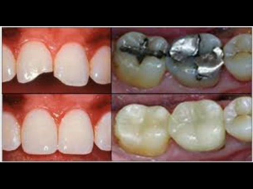 Dr.Robert Tupac DDS Dental restoration