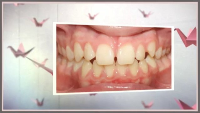 Orthodontists Dallas August 2013