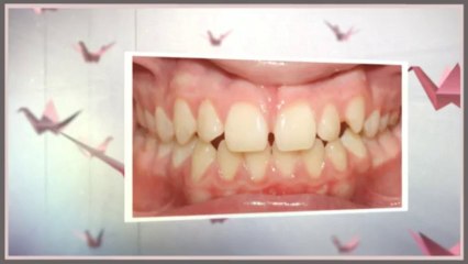 Orthodontists Dallas August 2013