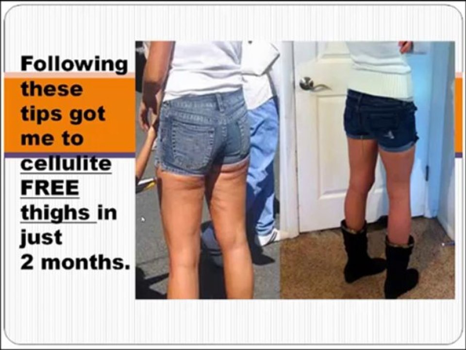 cellulite treatment tip 5