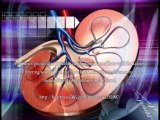 Hypertensive Kidney Disease Symptoms, What Are Hypertensive Kidney Disease Symptoms