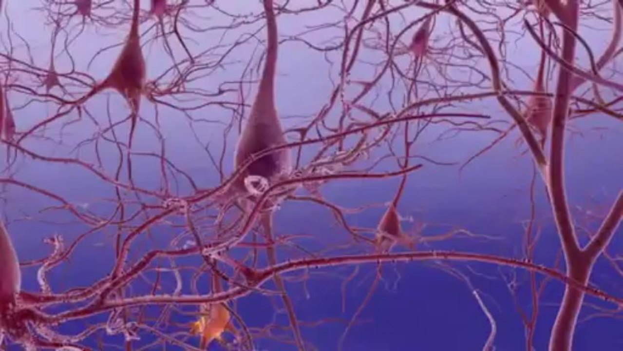 Unraveling Alzheimes Disease