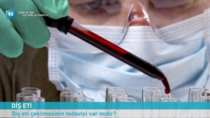 Diş eti çekilmesinin tedavisi var mıdır?