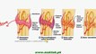 FSc Biology Book2, CH 16, LEC 10, Repair of Broken Bones