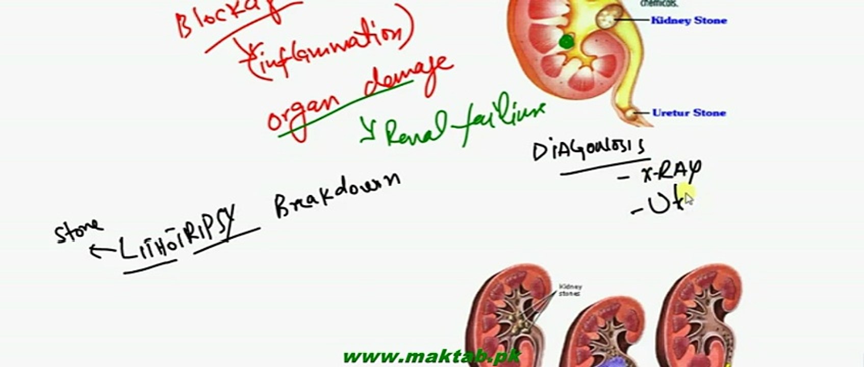 FSc Biology Book2, CH 15, LEC 13, Kidney Problems and Cures
