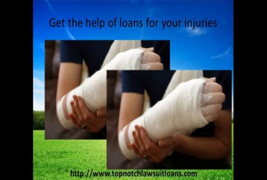 Supportive Commercial lawsuit loans and lawsuit funding at TopNotch