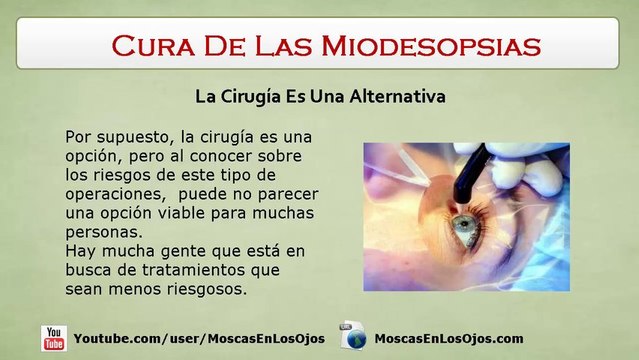 Miodesopsias Cura - Cual Es El Tratamiento Mas Efectivo Para Las Miodesopsias o Moscas En Los Ojos