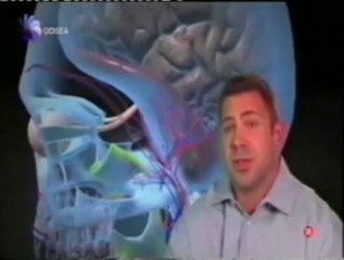 TCE: Muerte por pelota de golf