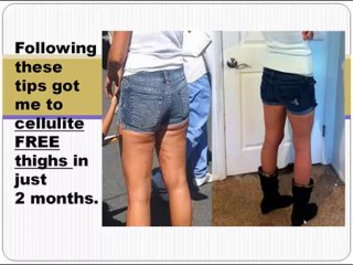 How to lose cellulite fast and naturally tip 3