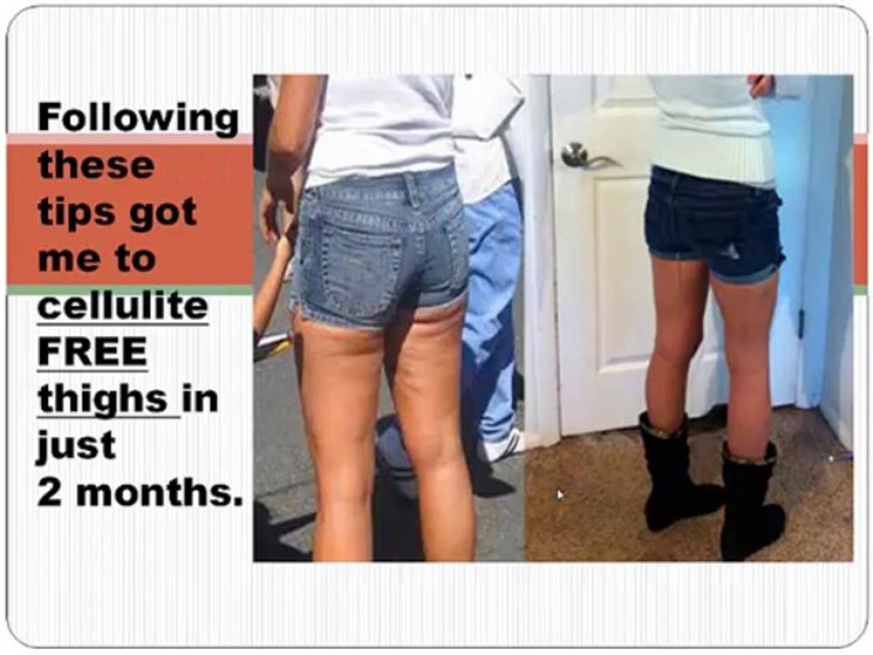 get rid of cellulite fast and naturally tip 6