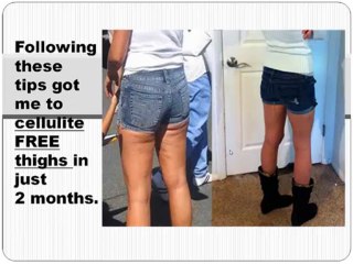 Reduce cellulite tip 8