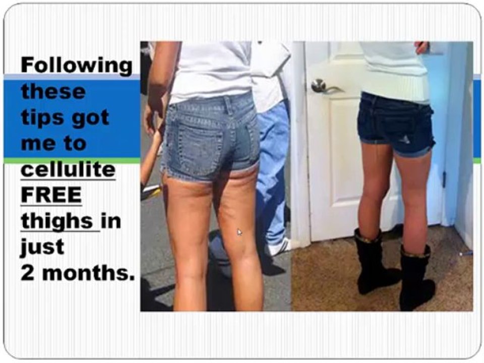 get rid of cellulite fast tip 9