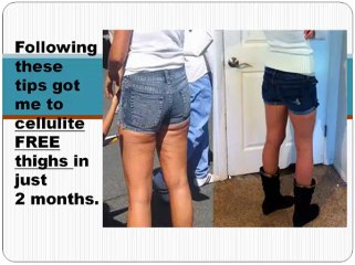 get rid of cellulite fast tip 19