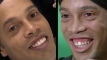 Les nouvelles dents à 50 000€ de Ronaldinho !