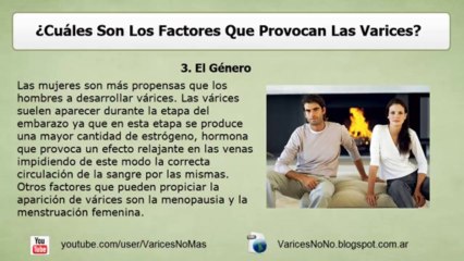 Varices - ¿Cómo Prevenirlas con simples hábitos?