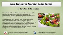 ¿Cómo Prevenir Las Varices?
