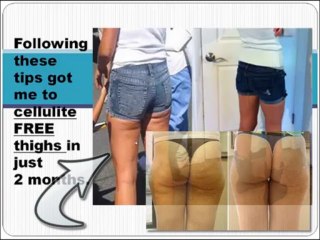 cellulite treatment tips 7