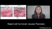 Types of Psoriasis Session 3 - Different Types of Psoriasis Explained