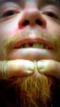 It's time to pop some tiny zits on my nose again - that come out like little maggot worms looking all squirmy and wiggly