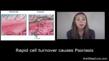 What Triggers Psoriasis Session 2 - What Triggers Psoriasis Flare Ups