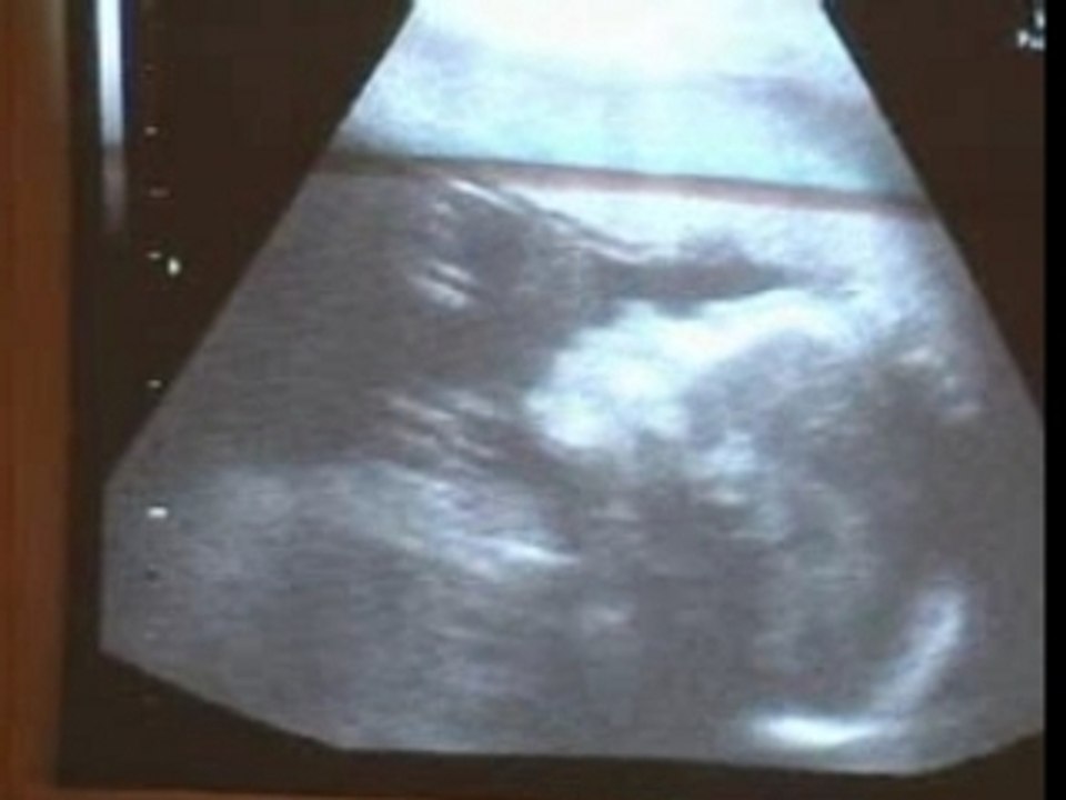 bb nov 06