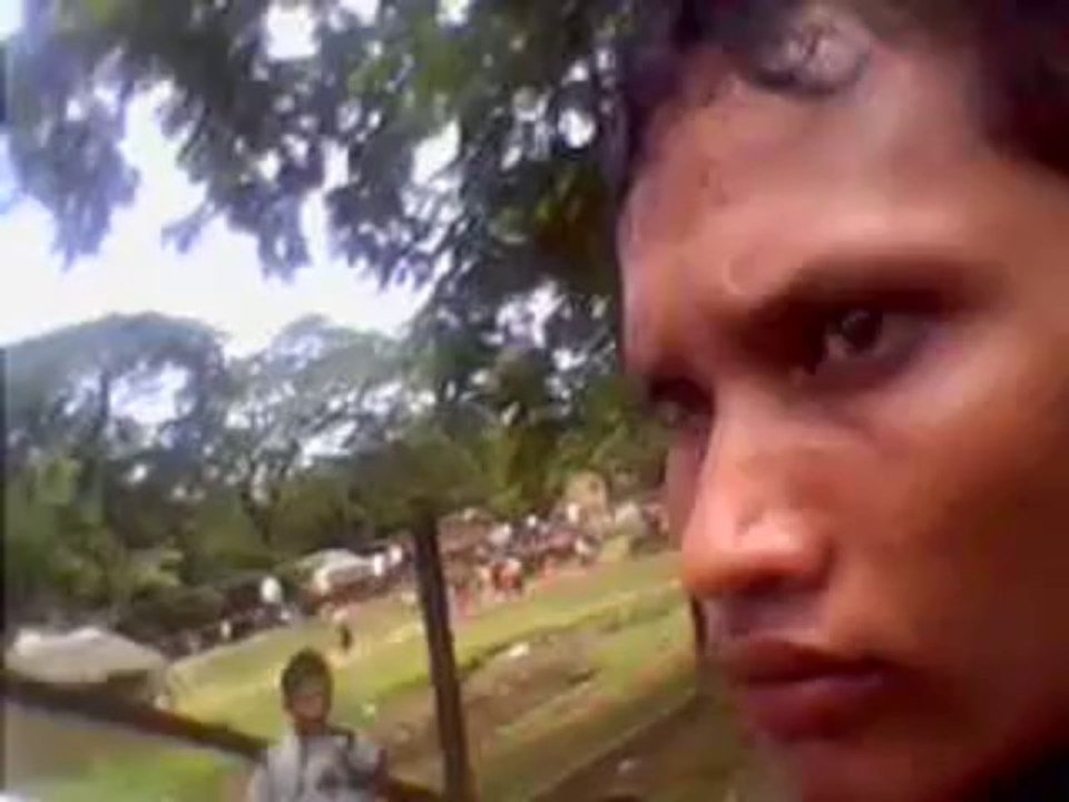 Rohingya man hit in the knee by Buddhists when he went to defend his family  شاب روهنجي أصاب  في ركبته من قبل البوذيين عندما ذهب ليدافع عن أهله