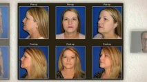 Inland Empire Cosmetic Surgery - 888.779.5912 Call Now! Ben J. Childers, MD, FACS
