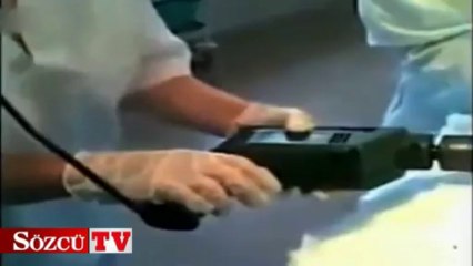 Ameliyatta inşaat aletleri kullandılar