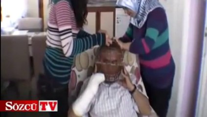 Sigara içmemek için başına tel kafes geçirdi!