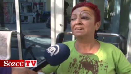 Yolcu otobüsü kamyonla çarpıştı