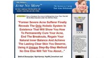 Acne No More Review - How To Get Rid Of Acne Scars Incredibly Fast