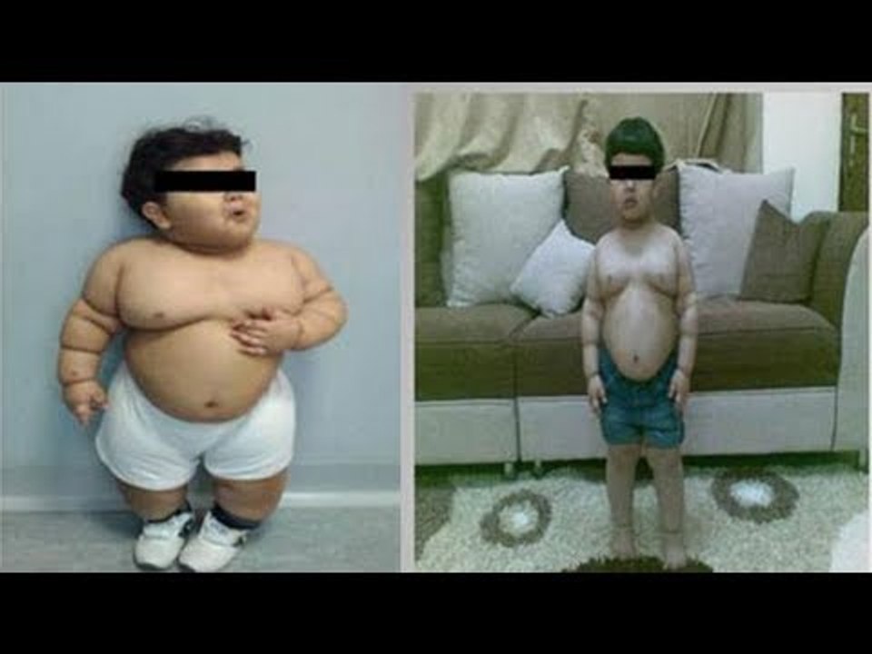 Before and After: Fat baby weight loss [PICTURE...