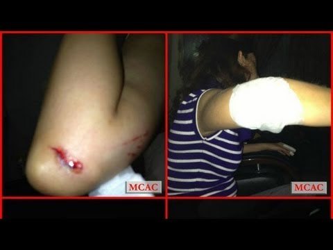 Woman attacked in kidnapping attempt in Malaysia