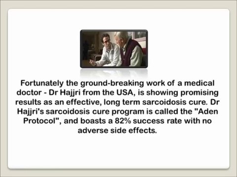 Natural Remedies For Sarcoidosis - treatments for sarcoidosis