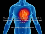 Statin Drugs Heart Disease, Does Statin Drugs Really Help Heart Disease