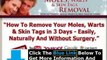 Mole Wart Removal Product Reviews + Moles Warts Skin Tags Removal Ebook Download