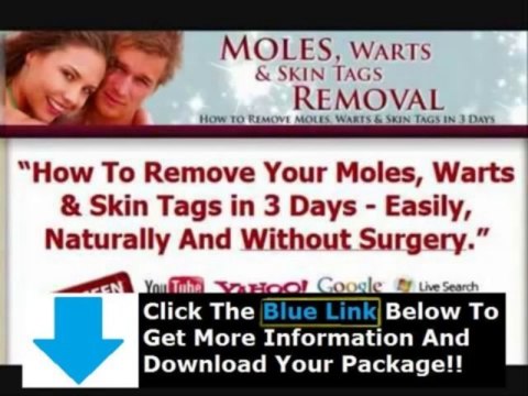Mole Wart Removal Product Reviews + Moles Warts Skin Tags Removal Ebook Download