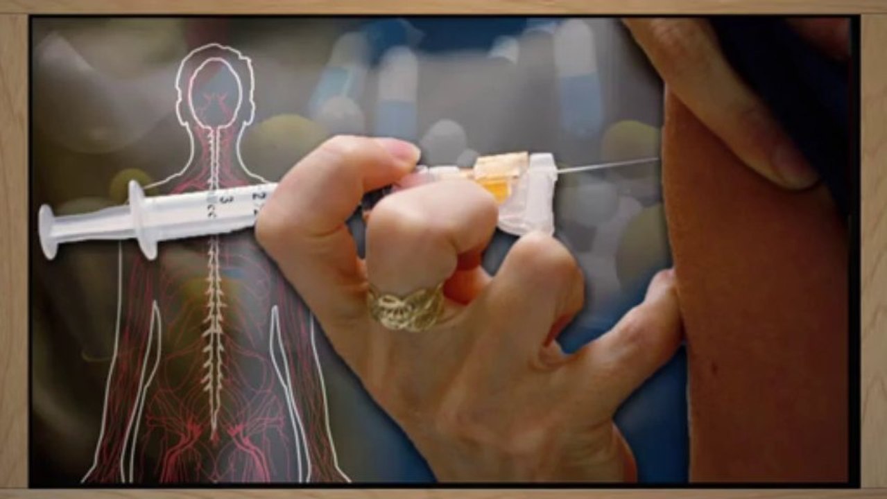 Esclerosis múltiple