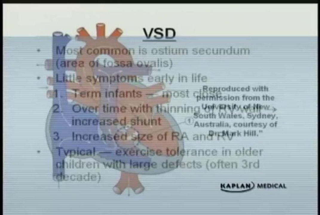 Left to Right Shunts in Heart - Acyanotic Heart Disease in Infant