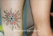 easy way get rid tattoo - Tattoo Removal Cream