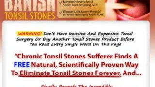 Banish Tonsil Stones EBook Free Download | Banish Tonsil Stones Download