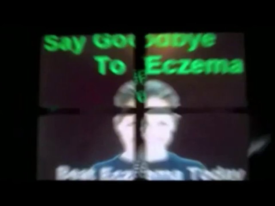 Beat Eczema review