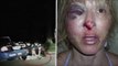 Police brutality: Tallahassee cops break Christina West's cheek in DUI stop