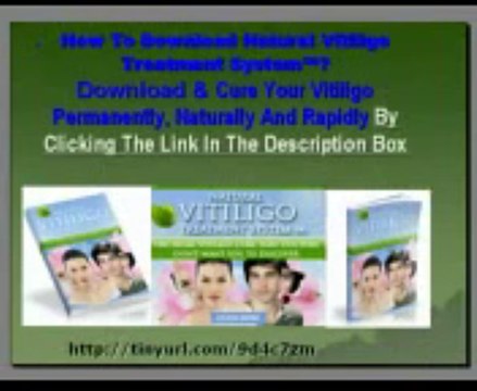Natural Vitiligo Treatment System Review - Is it Legit or Sc