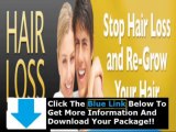 Hair Loss Black Book Reviews + The Hair Loss Black Book Download