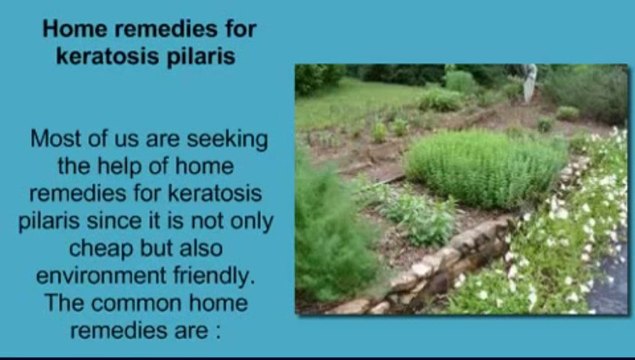 Living With KP - How to Treat and Manage Keratosis Pilaris Naturally -Review