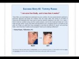 Acne No More Review | Inside Mike Walden's Acne No More Ebook