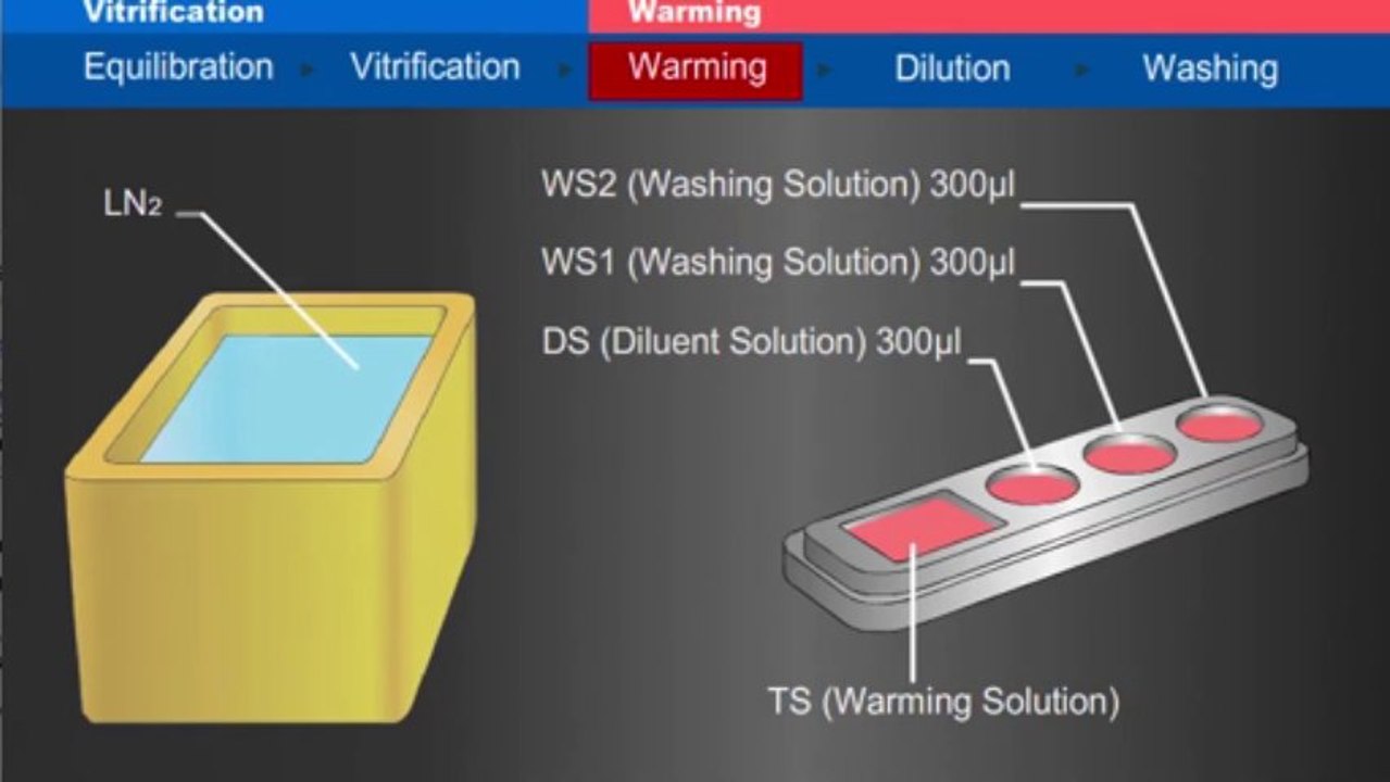 Protocol of Vitrification of Human Oocytes, Embryos, and Blastocysts