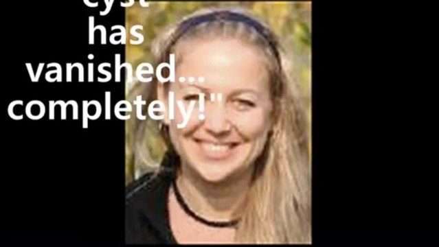 Symptoms of Ovarian Cyst Ovarian Cyst Miracle- Bonuses $365.87!