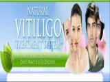 Natural Vitiligo Treatment System Reviews|Natural Vitiligo Treatment System